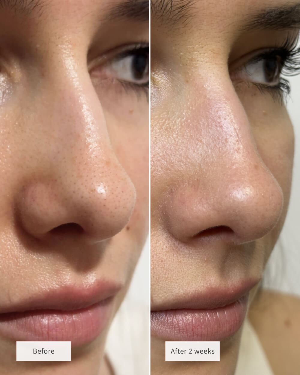 💟💟NAVODILO®Choose Your BundleDeep-Clean Nose Strips – Removes Blackheads & Tightens Pores