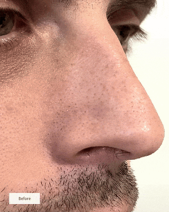💟💟NAVODILO®Choose Your BundleDeep-Clean Nose Strips – Removes Blackheads & Tightens Pores